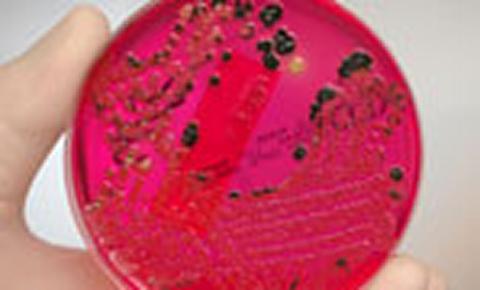 Petri dish with blood agar (Credit: John Goodman, Royal College of Pathologists)